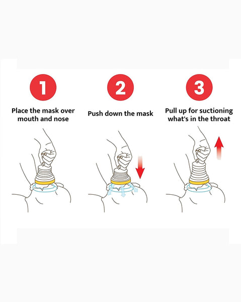 LifeVac Choking Rescue Kit